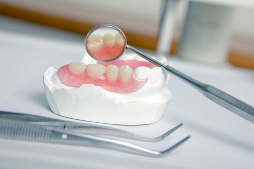 Dentures Mold For Patient - Partial Dentures