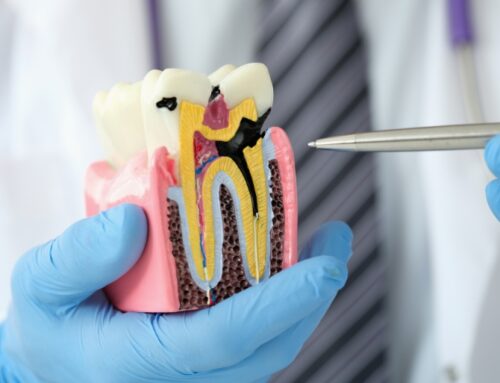 How to Prevent Cavities in Children: A Parent’s Guide to Best Practices