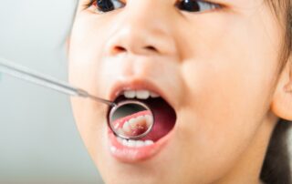 Child receiving dental checkup at Brighter Smiles Family Dentistry in West Des Moines, IA – how to prevent cavities in kids with early professional care