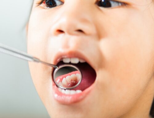 How to Prevent Cavities in Kids: Best Practices Every Parent Should Know